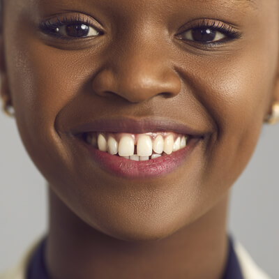 tooth replacement options