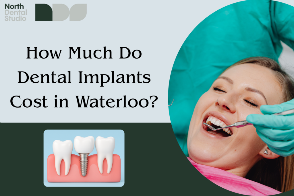 Dental Implants Cost in Waterloo