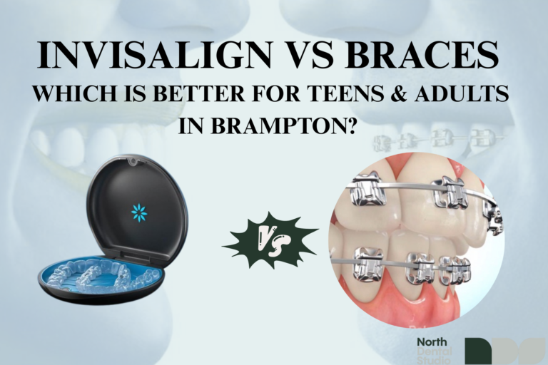 Invisalign vs Braces in Waterloo – Best Option for Teens & Adults