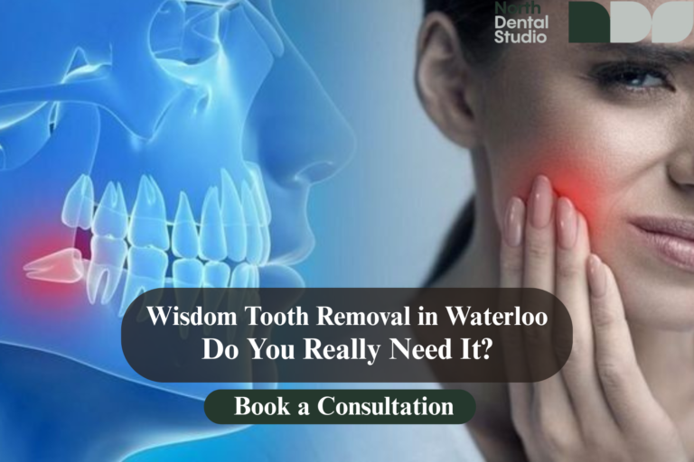 wisdom tooth removal Waterloo