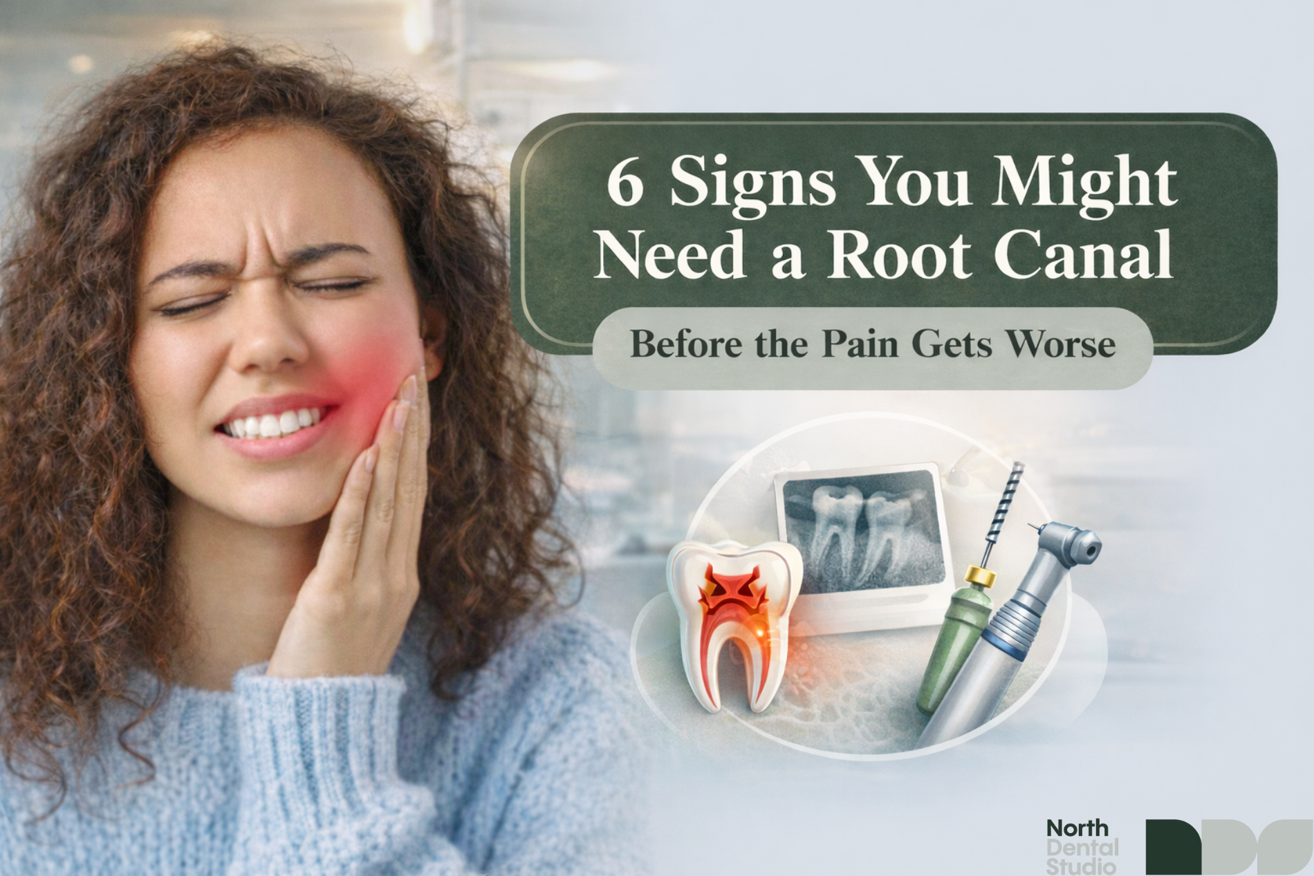 Root Canal Waterloo: 6 Early Signs You Might Need One