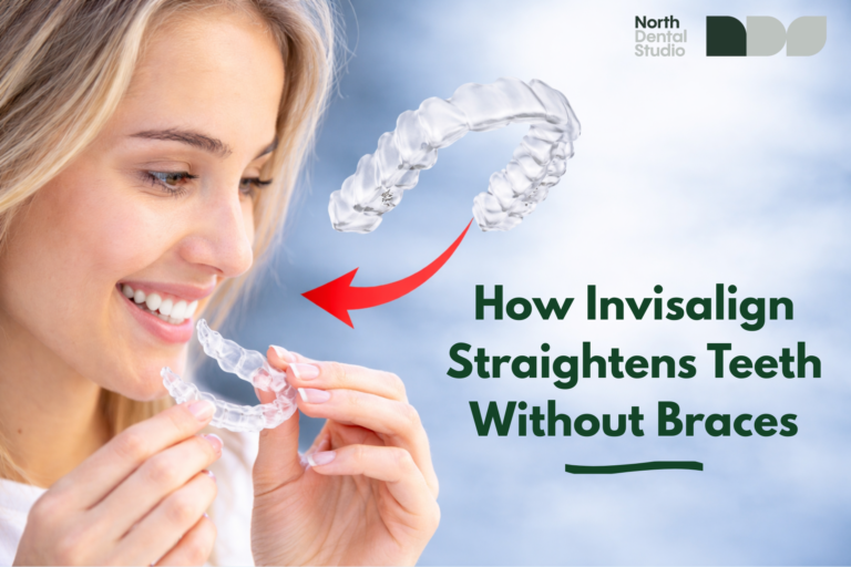 Invisalign treatment Waterloo