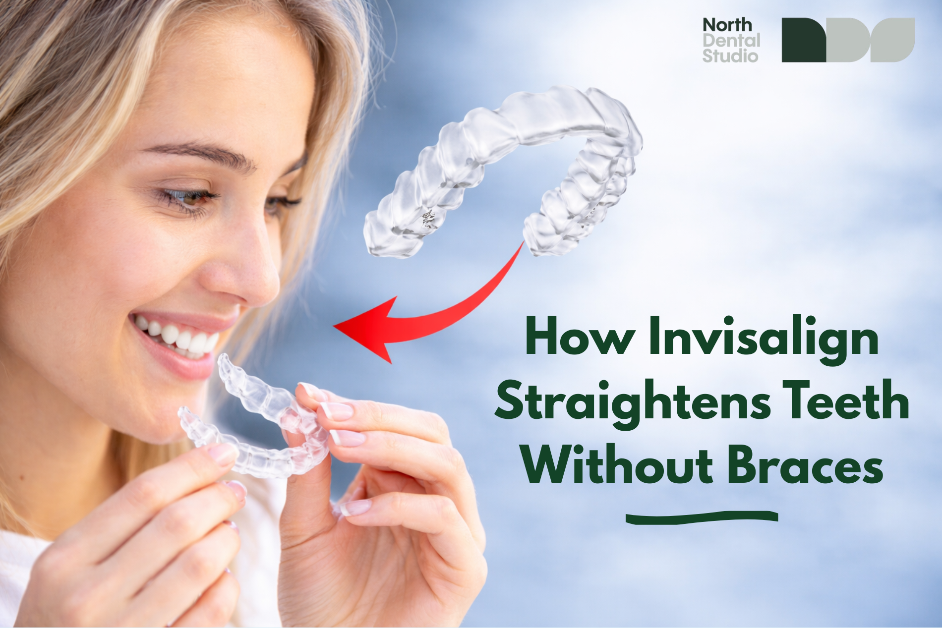Invisalign treatment Waterloo