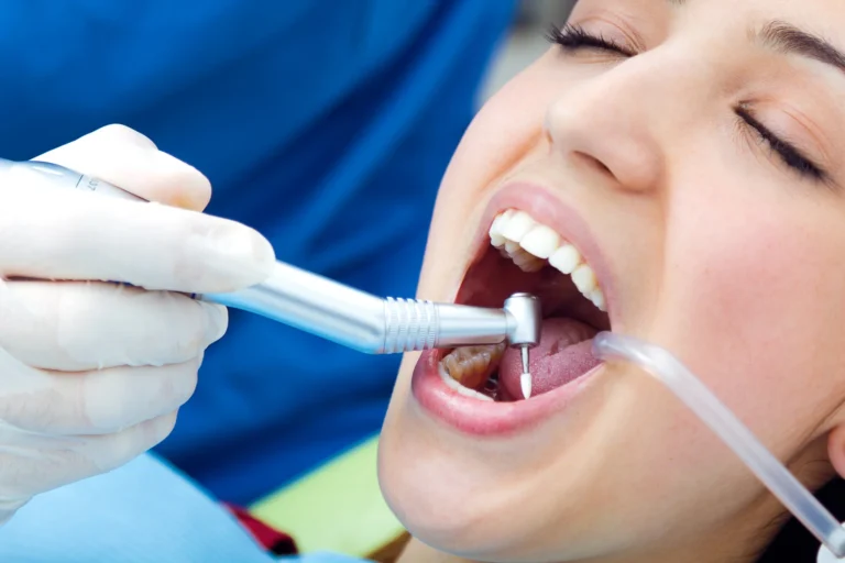 choosing the right teeth cleaning
