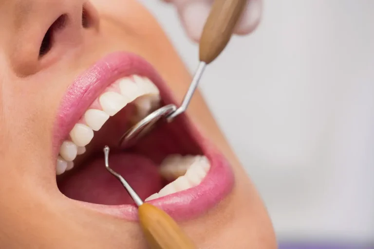 professional teeth whitening in Waterloo