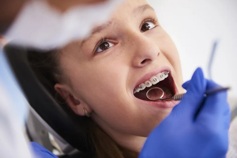 Invisalign vs braces for kids