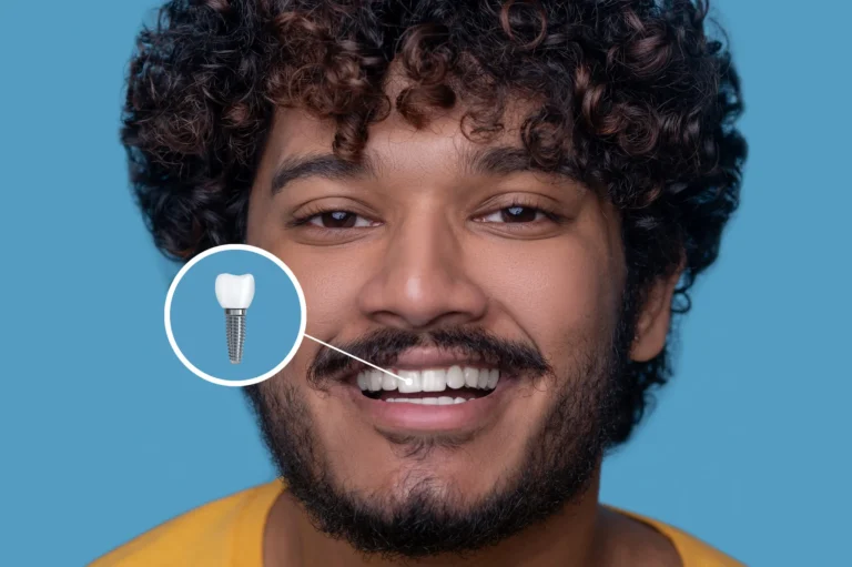 types of dental implants